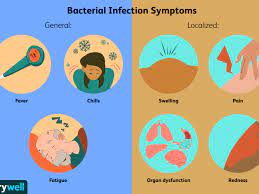 Bacterial Infections Symptoms Causes Diagnosis And Treatment
