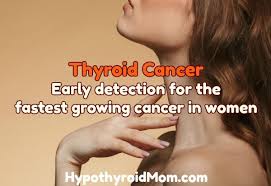 The first thing to note (if you do have any lumps on your thyroid), is that something like 95% of them are benign (not cancer)! Thyroid Cancer Early Detection For The Fastest Growing Cancer In Women Hypothyroid Mom