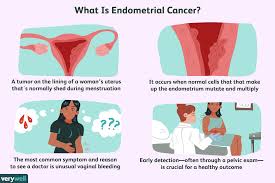 Carcinoma is divided into the form of formations, the degree of differentiation, as well as the direction of growth. Endometrial Cancer Overview And More