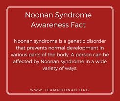 Noonan Syndrome Awareness Fact 1 2017 Noonan Syndrome Noonan Genetic Disorders