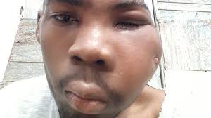 Fundraiser for Rubena Barnaby by Stacy-Ann Williams-Barclay : Help for  Jovayne Bailey