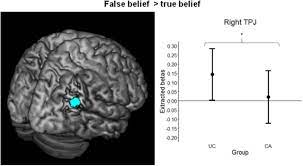 Find out what is the full meaning of rtpj on abbreviations.com! Spontaneous Mentalizing After Early Interpersonal Trauma Evidence For Hypoactivation Of The Temporoparietal Junction Biorxiv
