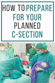 Preparing For A C Section Ultimate Guide C Section Hospital Bag How To Plan