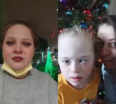 St Louis Childrens Hospital Diabetes