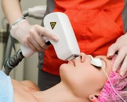 Imagem de Laser, um procedimento da beleza full face
