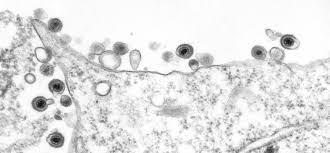 Electron microscope rhinovirus under microscope. How To Catch The Flu Under The Lens