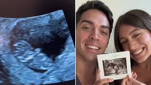 Hot Purple Wiggle' John Pearce and his pregnant wife Jessie Adamo put