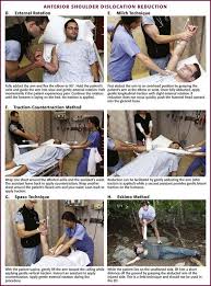 Image result for Shoulder Relocation Maneuvers