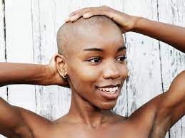 The more we openly discuss hair loss with no. 5 Things I Learned About Alopecia On My Hair Growth Journey Essence