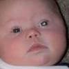 A pupil that looks white, instead of the normal black a crossed eye, which is an eye looking either toward the ear or toward the nose 1
