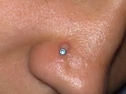To avoid the keloid scar you should stay away from the nose ring. Piercing Infection 4 Ways To Heal Fast Infected Ear Nose Piercing