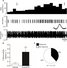 5 Oxoete Triggers Nociception In Constipation Predominant