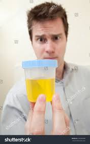 Man Holding Urine Sample Drug Test Stock Photo 106583048