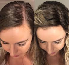 Polycystic ovary syndrome (pcos) is another possible causes of hair thinning for women. What Are The Best Hairstyles For Very Thin Hair Hair Adviser