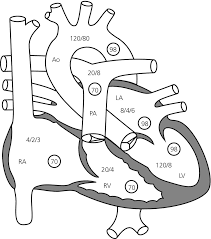 When stressed, heart rates will increase. 11 Heart Rate Rhythm And Contractility Veterian Key