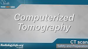 The costs for specific medical imaging tests, treatments and procedures may vary by geographic region. Cat Scan Ct Spine