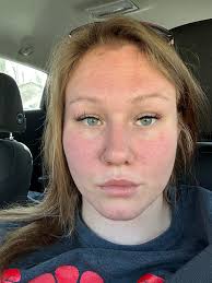 CBD facial products for sensitive skin