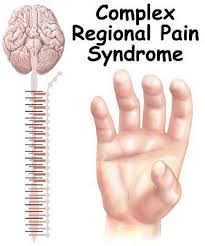 Pin On Other Chronic Illnesses