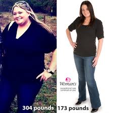 Pin On Weight Loss Surgery