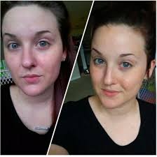 Has vitamin c, electrolytes & other nutrients. 27 Skincare Products With Before And After Photos That Ll Blow Your Damn Mind