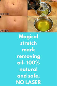 Pin On Stretch Mark Removal Cream