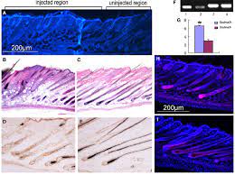 The very best free tools, apps and games. Changes Of Hair Follicle Morphous And Increase Of Apoptosis In The Hair Download Scientific Diagram