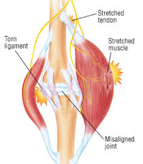 Think of the front leg as the 'working leg' and the back leg as the 'supporting' leg. Leg Strain Harvard Health