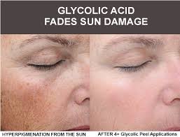 Pin On Get Glowing Skin