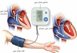 علت بالا بودن مینیمم فشار خون چیست دکتر سعید یزدانخواه فوق تخصص قلب و عروق در تهران