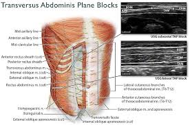 There are multiple anatomical areas within the abdomen, each of which contain specific contents and are bound by certain borders. Anatomy Of The Anterolateral Abdominal Wall And The Us Guided Usg Download Scientific Diagram