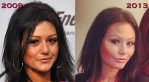 Erik hoy ­long before anyone thought to nip and tuck or even heard of. Plastic Surgery Debsblogspot