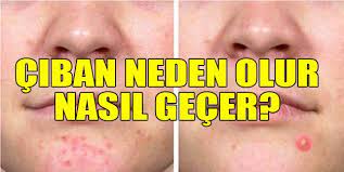 Ciban Neden Cikar Ciban Ne Iyi Gelir