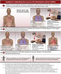 The early symptoms may be mild, such as a. Anaphylaxis A 2020 Practice Parameter Update Systematic Review And Grading Of Recommendations Assessment Development And Evaluation Grade Analysis Journal Of Allergy And Clinical Immunology