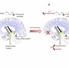 Le cortisol et les catécholamines sensibilisent les récepteurs thyroïdiens. Pdf Le Role Du Sommeil Dans La Consolidation Mnesique Effets De L Age Et De La Maladie D Alzheimer