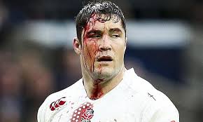 Maybe you would like to learn more about one of these? Common Rugby Injuries And How To Prevent Them