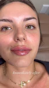 Meet our newest injector! Maria Marconi @injector_mariaelisa is a  board-certified Physician Assistant practicing in Aesthetics and Urgent  Care Medicine. She has been working in the medical field for over 10 years  and