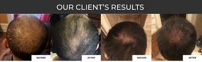 It is specially designed to act on follicle dysfunctions to achieve. Amazon Com Revita Hair Growth Stimulating Shampoo 205ml For Thinning Hair Hair Growth Beauty