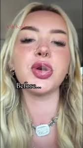 Kaila Mcmanus Before and After