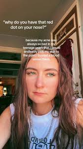 Popping A Face Vessel