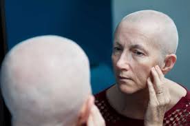 The anticoagulant, warfarin (coumadin), is a commonly used blood thinner that has been reported to cause hair loss. Taxotere Lawsuit Alopecia Permanent Hair Loss Impact Law