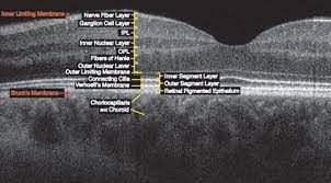 Optical Coherence Tomography Vision Science And Advanced Retinal Imaging Laboratory Optometry Optical Coherence Tomography Eyes Problems