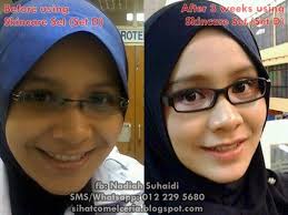 Google pun maybe tak faham? 3 Tips Cepat Dijamin Boleh Cantik