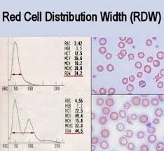 Image result for Red Cell Distribution Width