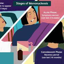 How Long Does Mono Last? The 3 Stages Of Mononucleosis
