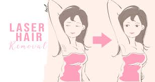 Six laser hair removal treatments on a small, medium, or large area at femcare health and beauty (up to 75% off). Laser Hair Removal Fix Me Up Medical Spa Salon