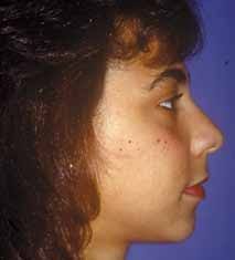 MASTER CLINICIAN R.G. “Wick” Alexander, DDS, MSD