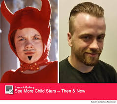 Michael hydrocephalus Oliver PROBLEM