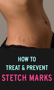 Pin On Women S Health News Tips