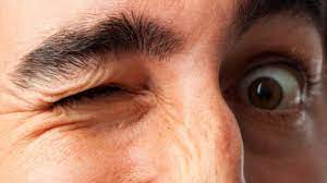 Obat Tradisional Untuk Mata Kedutan Sebelah Kanan Kiri Di Apotik Mata Kimia Bell S Palsy
