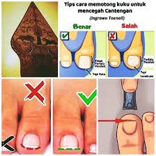 Bahwa yang dilarang memotong kuku dan rambut adalah orangnya bukan hewannya. Hari Baik Memotong Kuku Lengkap Dengan Dalil Dan Tata Caranya Kanalmu